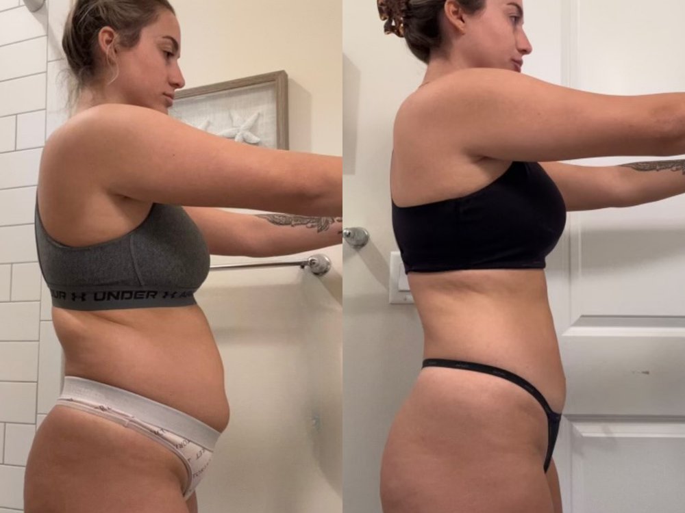 Alexa before and after — restored hormone balance
