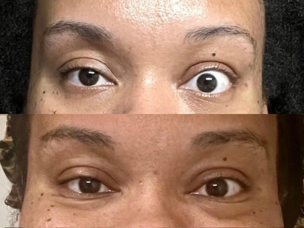 Brianna before and after — thyroid stability restored