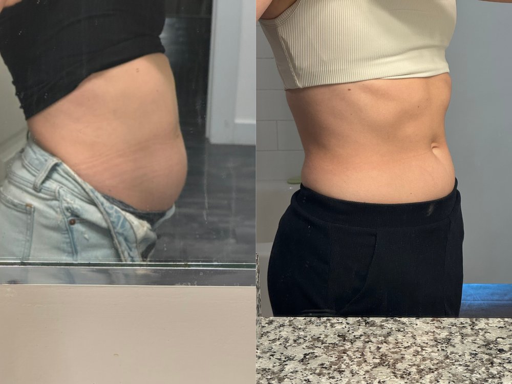 Carrie before and after — clearer skin and reduced bloating